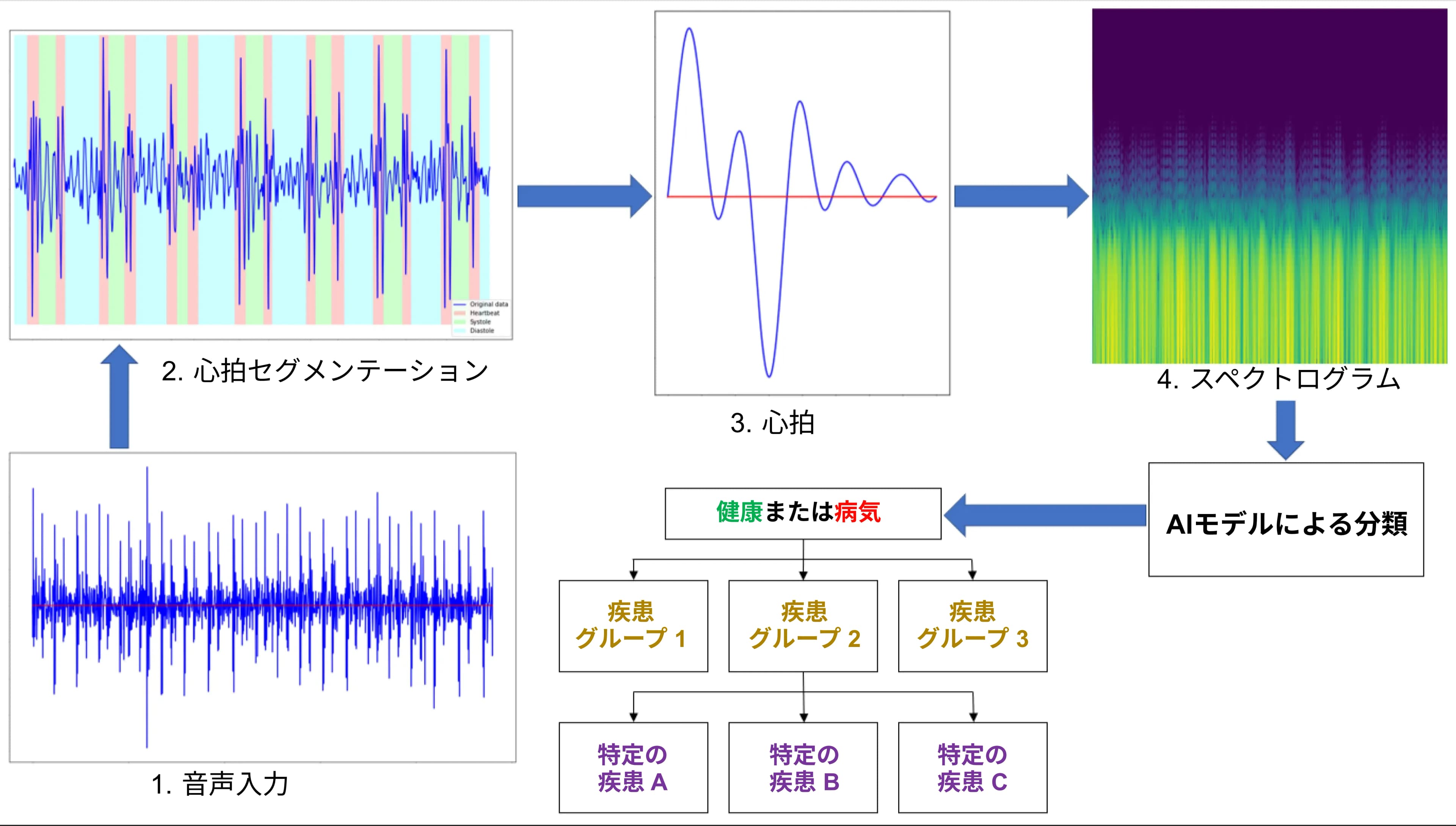 心臓病を音で診断するAI\nシステム